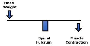 When a patient has anterior postural distortions along the sagittal plane, their head is projected forward of the fulcrum